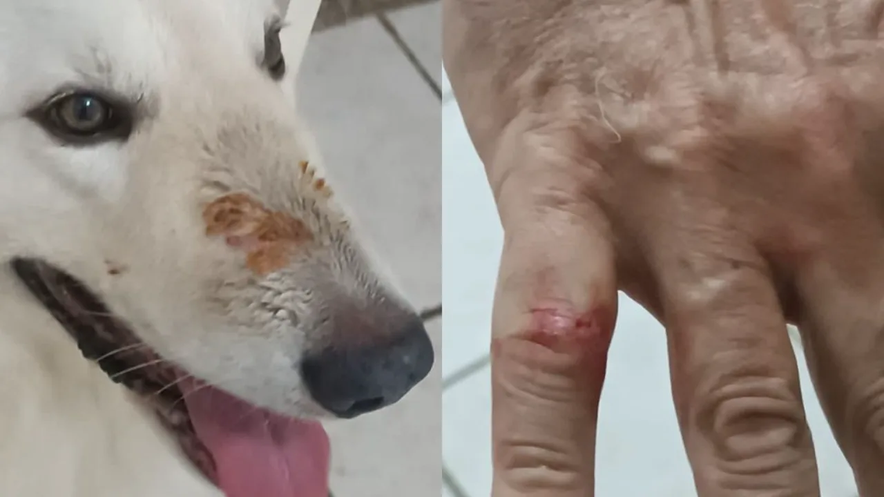 Ataque de pitbull no Grajaú deixa morador e seu cachorro de estimação feridos