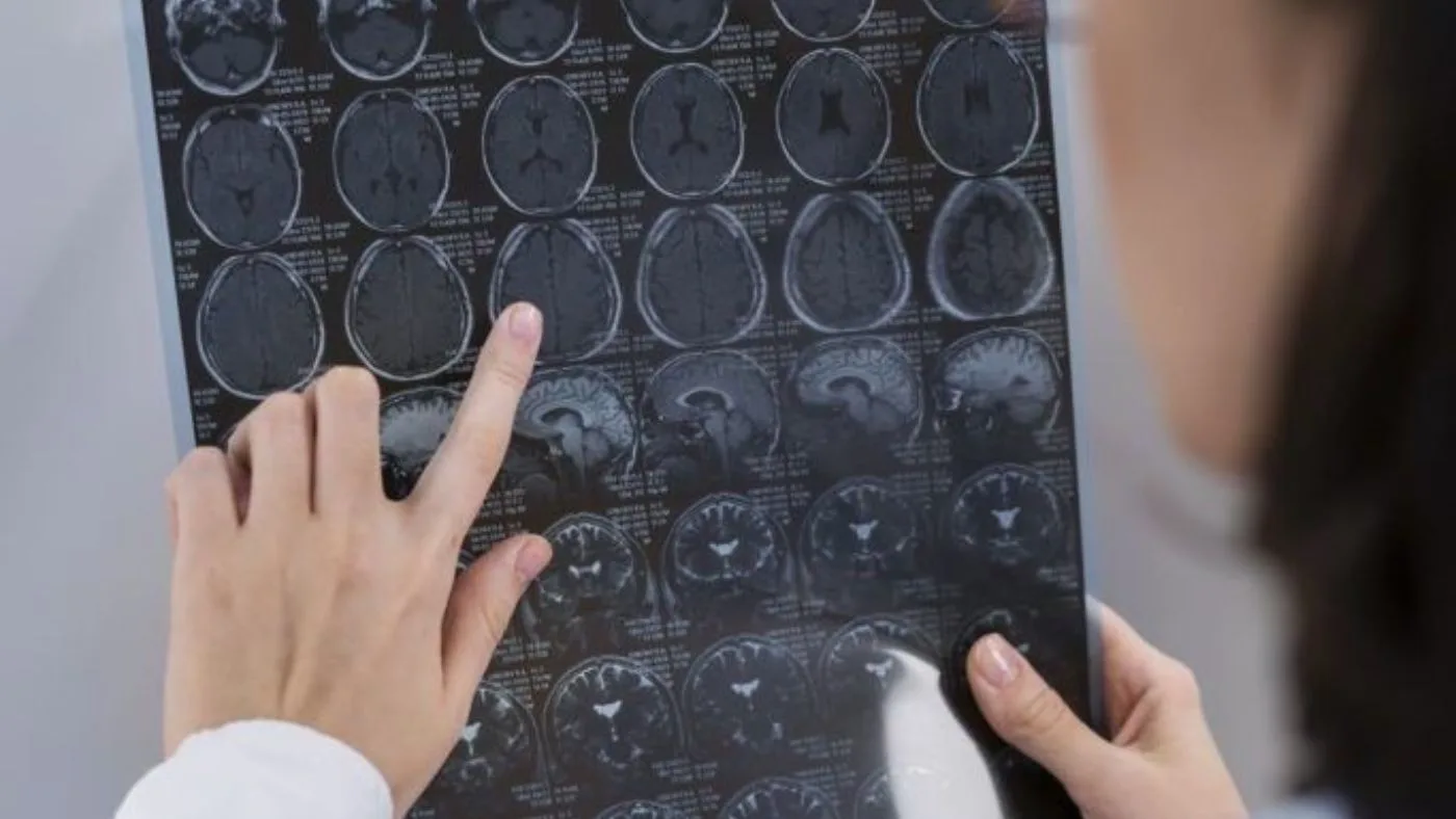 Plano de saúde negou medicamento de alto custo. O que fazer? 